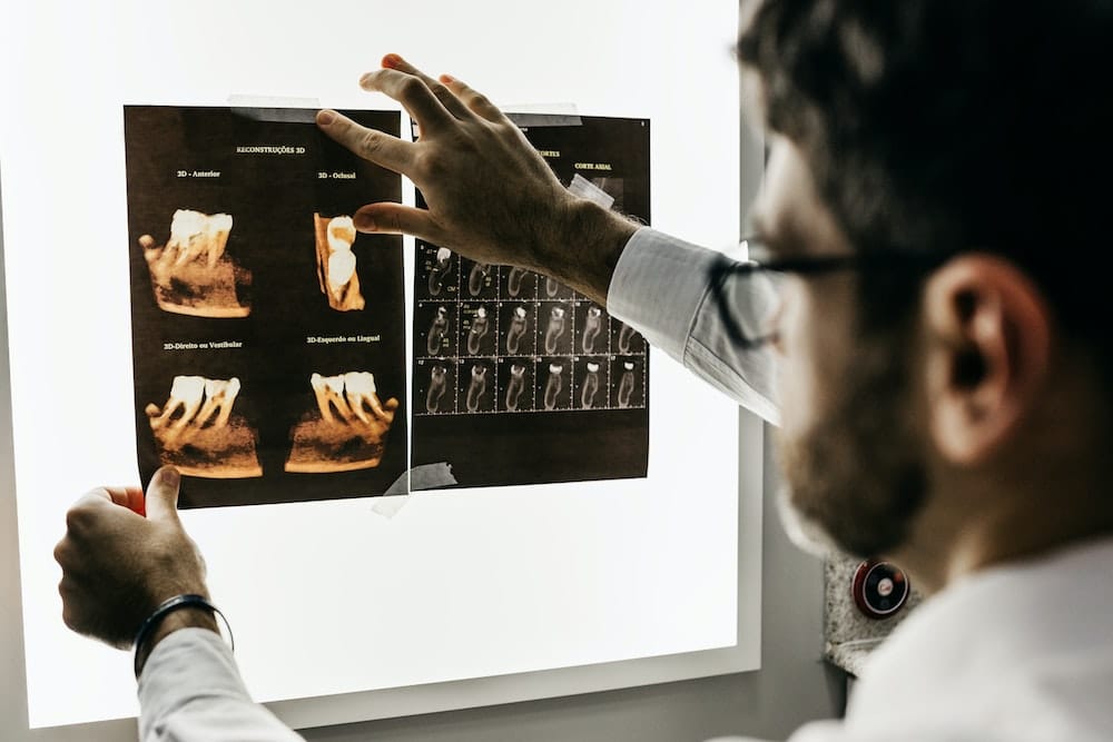 Dentist looking over dental xray scans on a light board
